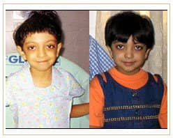 Slider image (7) Global Hospitals